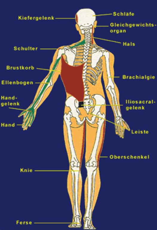 Possible complaints triggered by jaw-pelvis alignment - KFO Hannnover